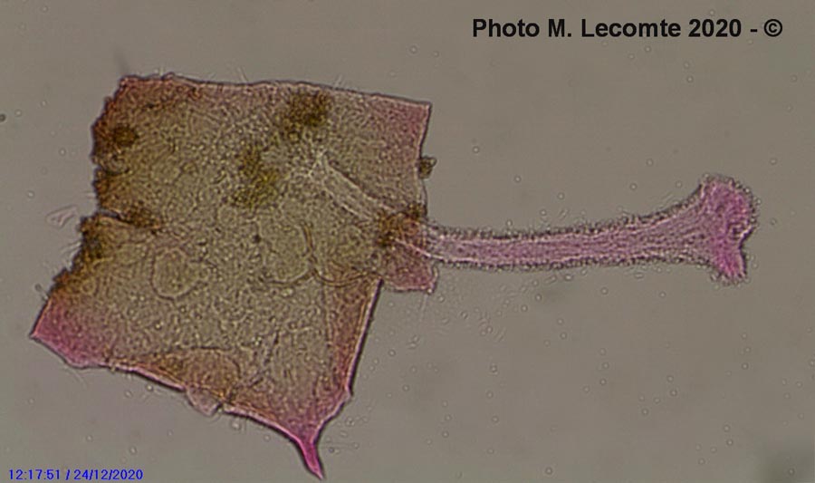 Polycephalomyces tomentosus