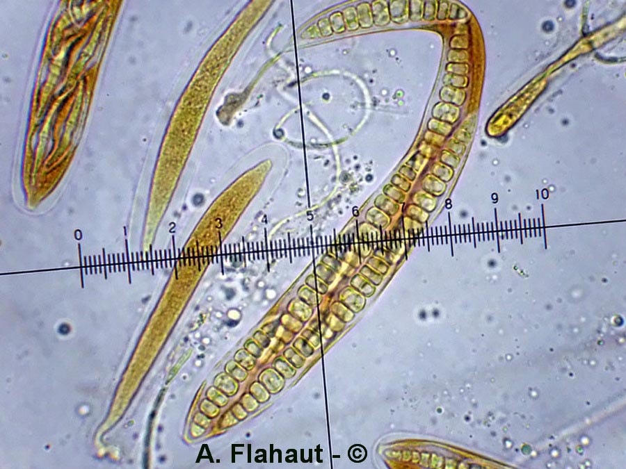 Pseudomassariosphaeria grandispora