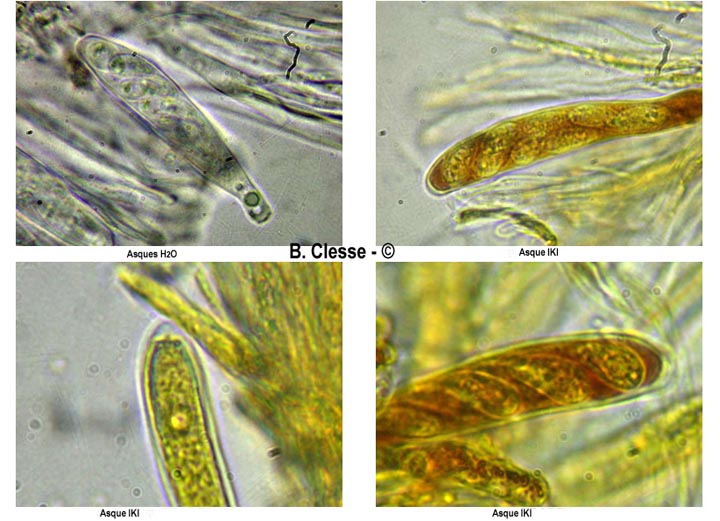Pseudopeziza trifolii