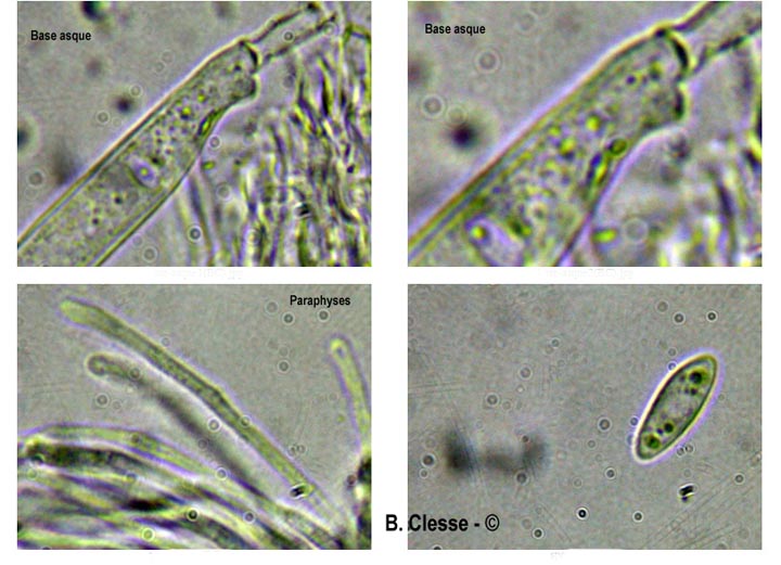 Pseudopeziza trifolii