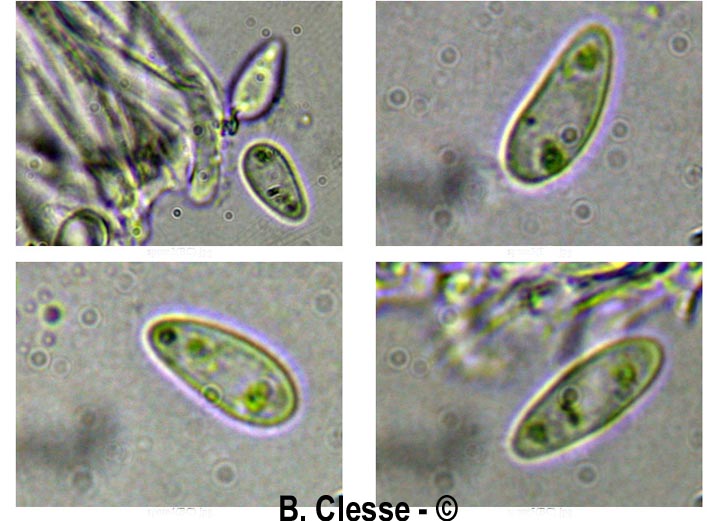 Pseudopeziza trifolii