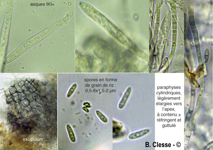 Pyrenopeziza petiolaris