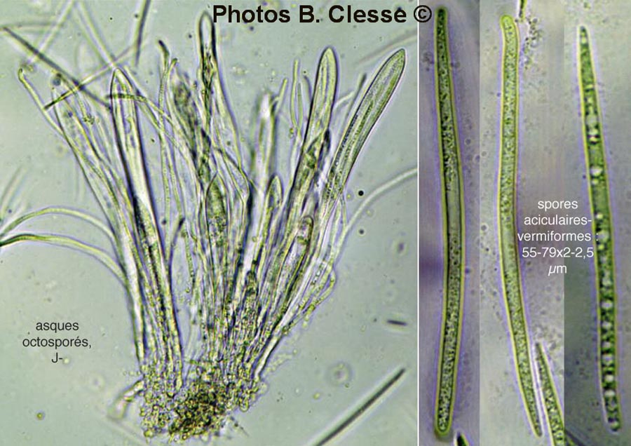 Rhytisma acerinum