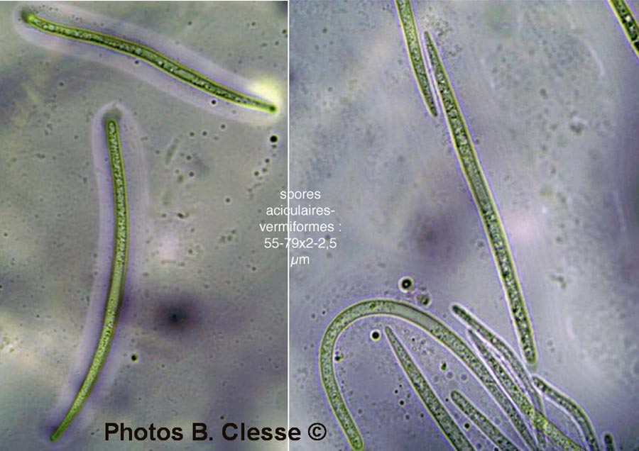 Rhytisma acerinum