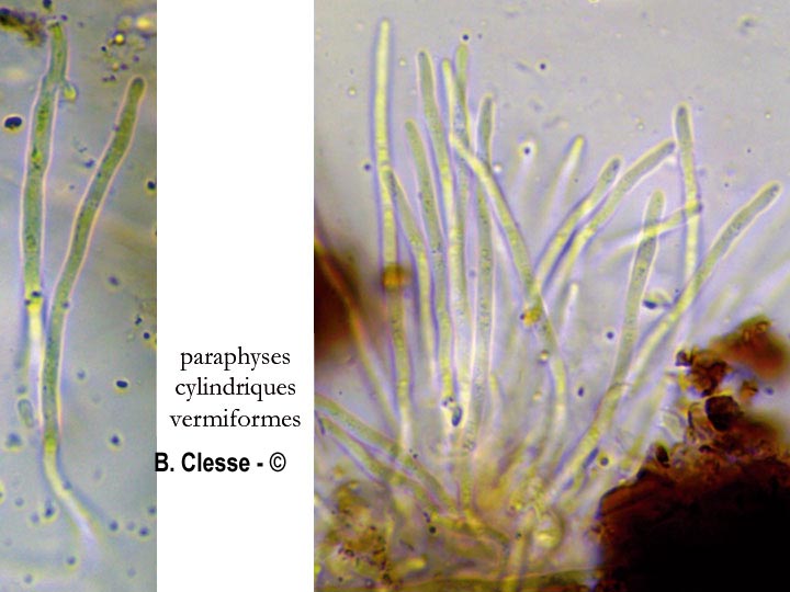 Sarea coeloplata