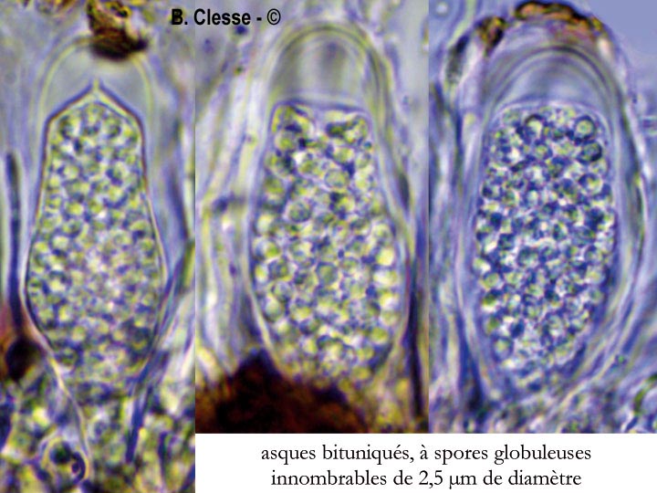Sarea coeloplata