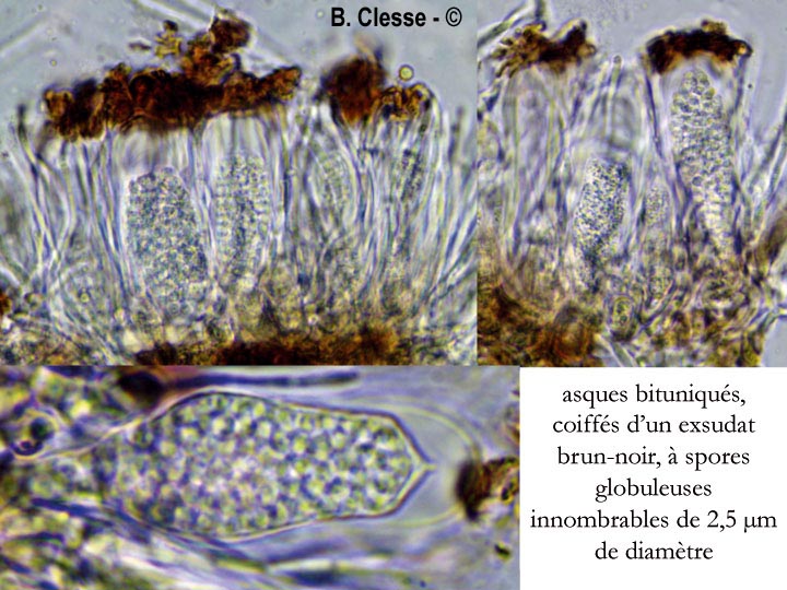 Sarea coeloplata