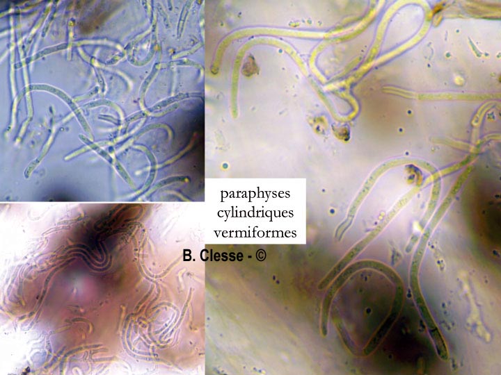 Sarea coeloplata