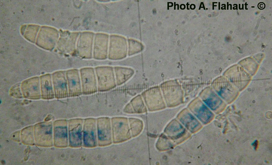 Stagonospora gigaspora