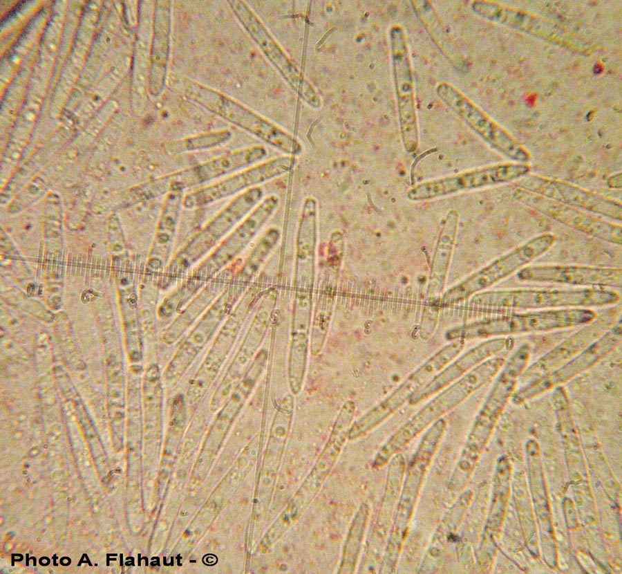 Stagonospora macropycnidia