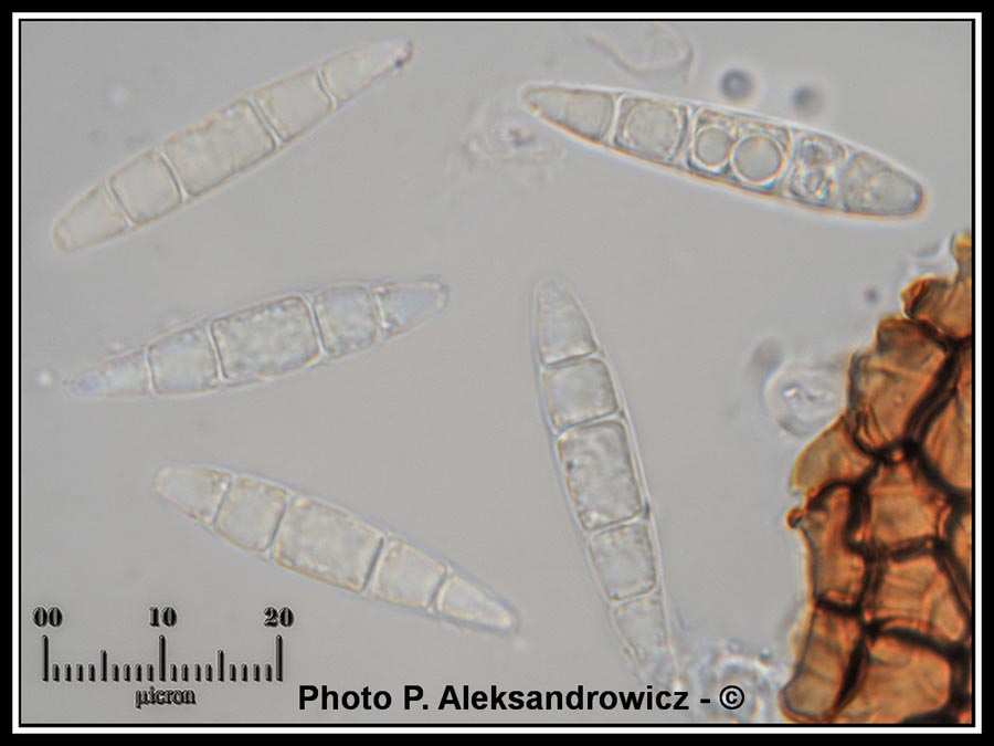 Stagonospora subseriata