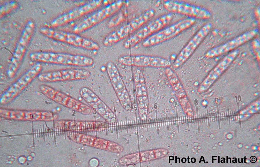 Stagonospora typhoidearum