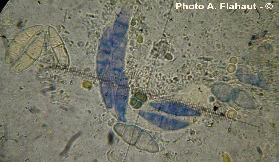 Trematosphaeria circinans