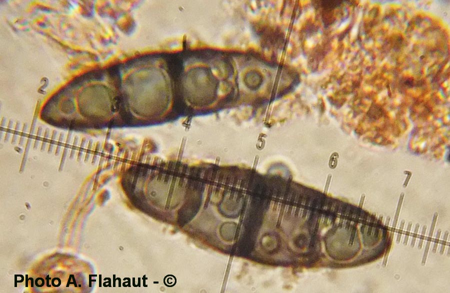 Trematosphaeria heterospora