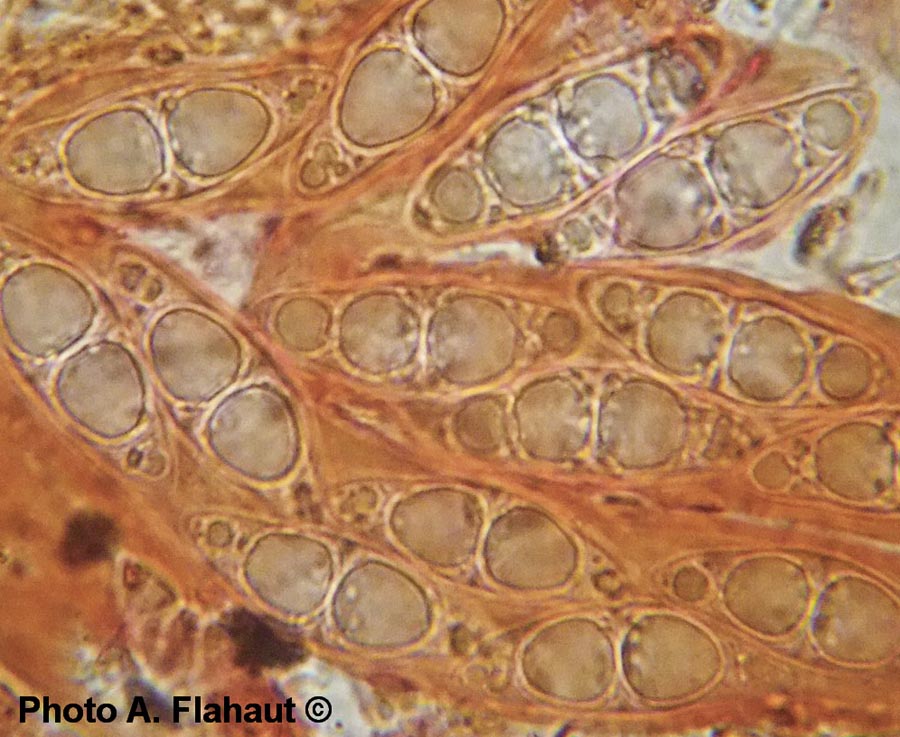 Trematosphaeria heterospora (Leptosphaeria heterospora)