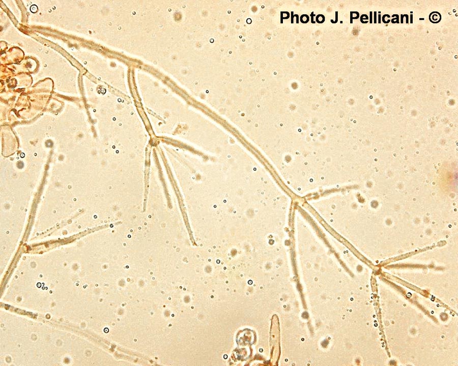 Verticillium sp.