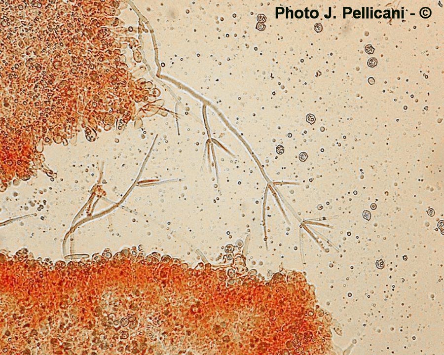 Verticillium sp.