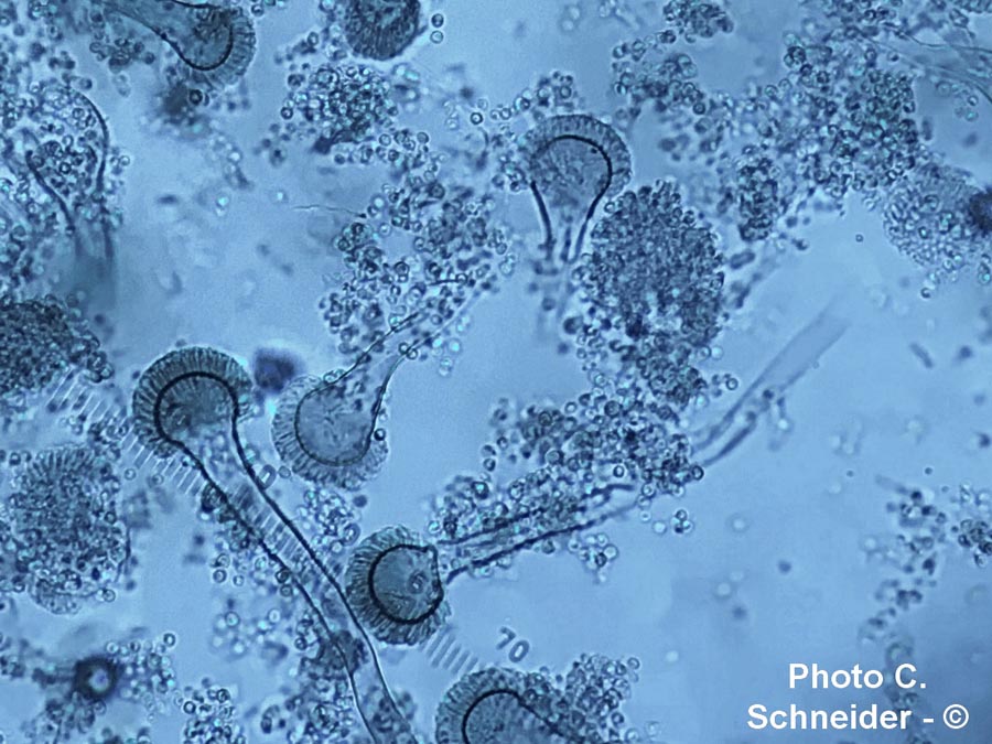 Aspergillus fumigatus