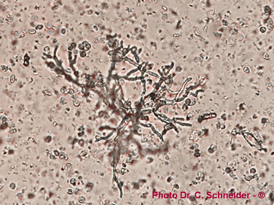 Aspergillus