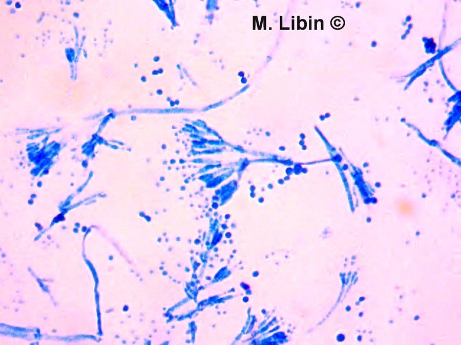 Penicillium expansum