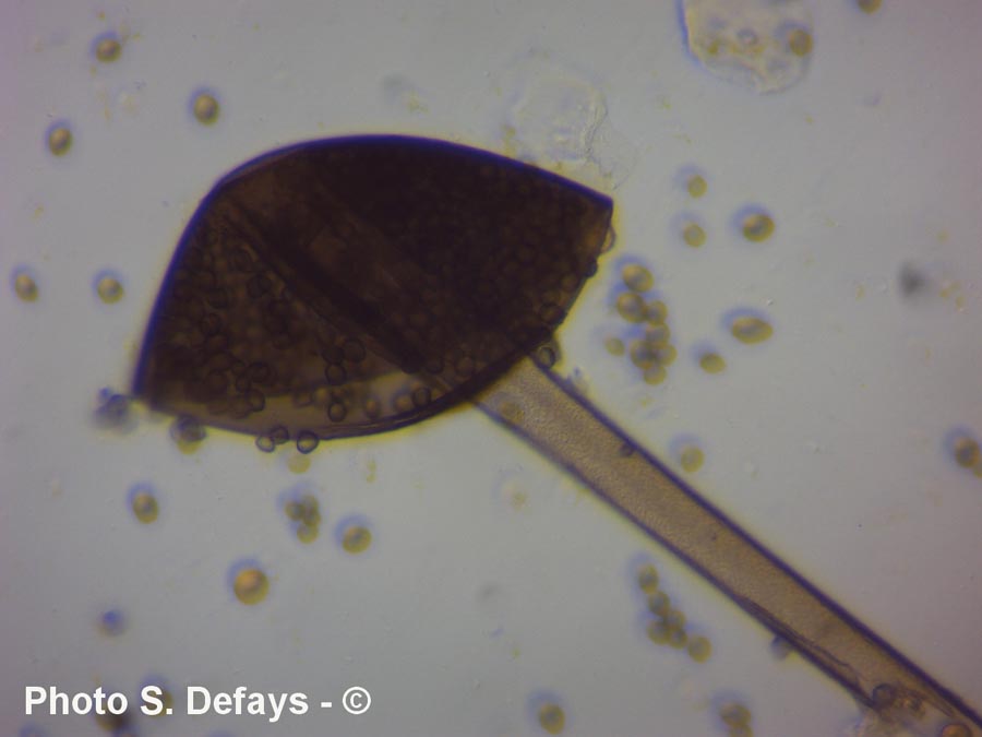 Rhizopus sp.