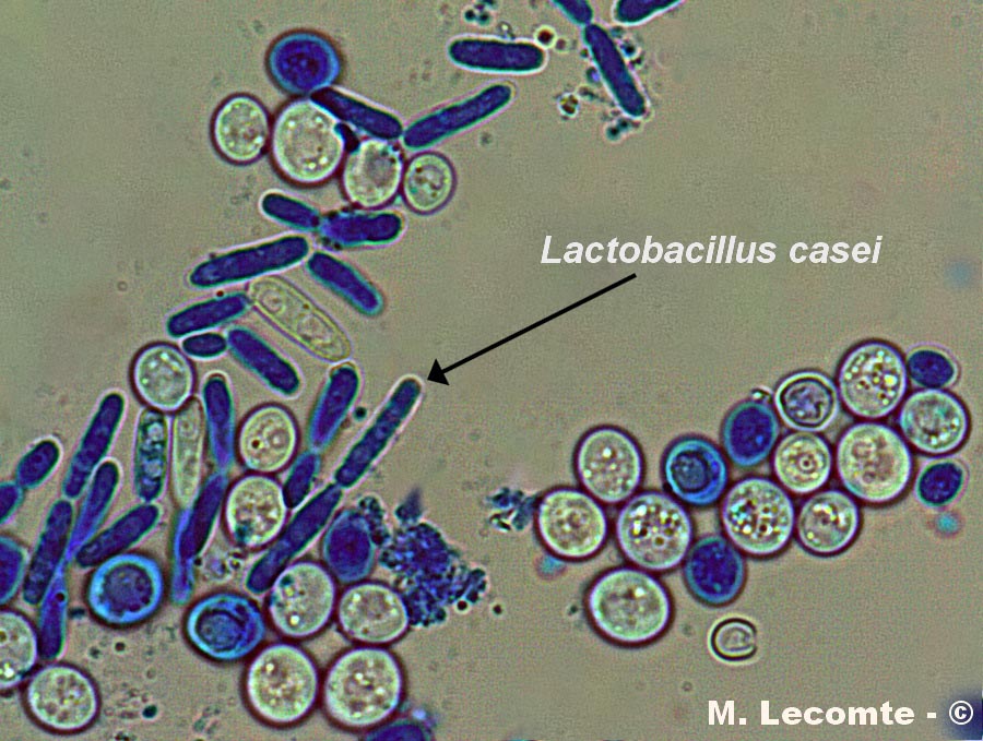 Saccharomyces cerevisiae