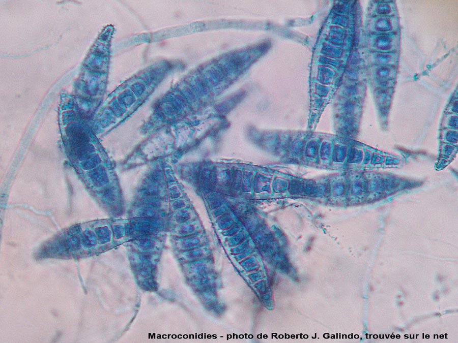 Microsporum canis