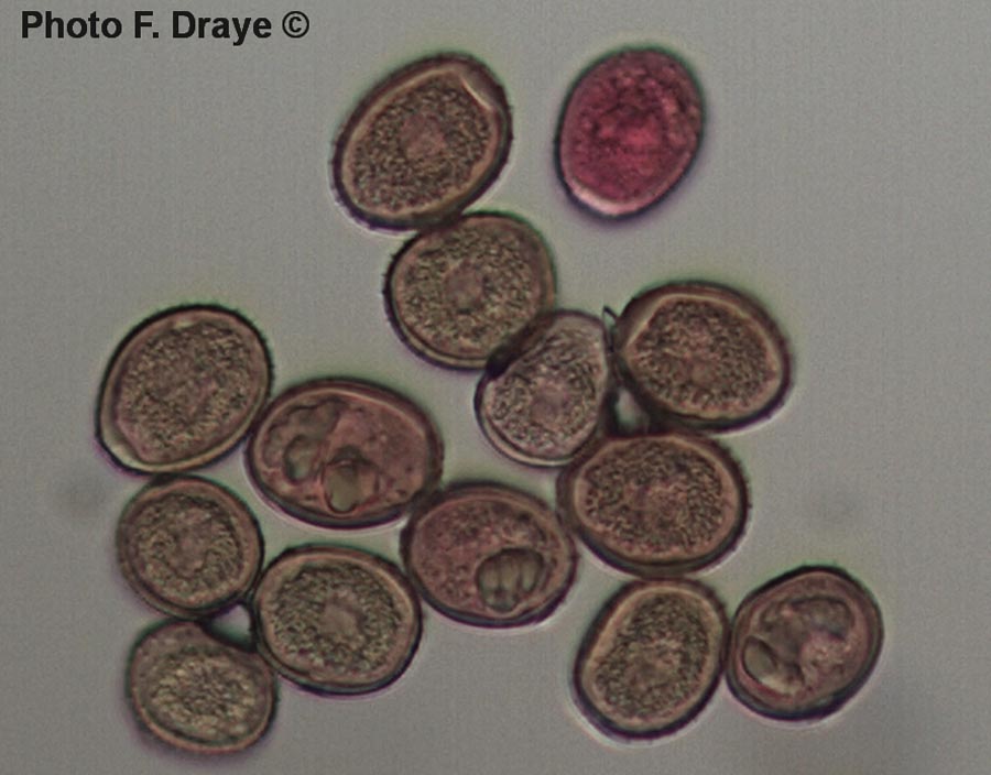 Puccinia polygonii-amphibii