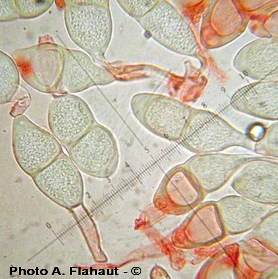 Puccinia annularis