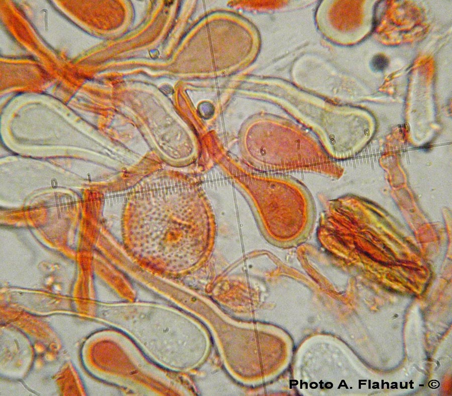 Puccinia brachypodii var. arrhenatheri