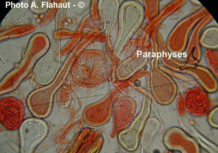 Puccinia brachypodii var. arrhenatheri