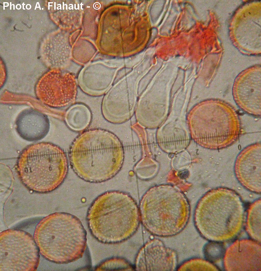 Puccinia brachypodii var. arrhenatheri