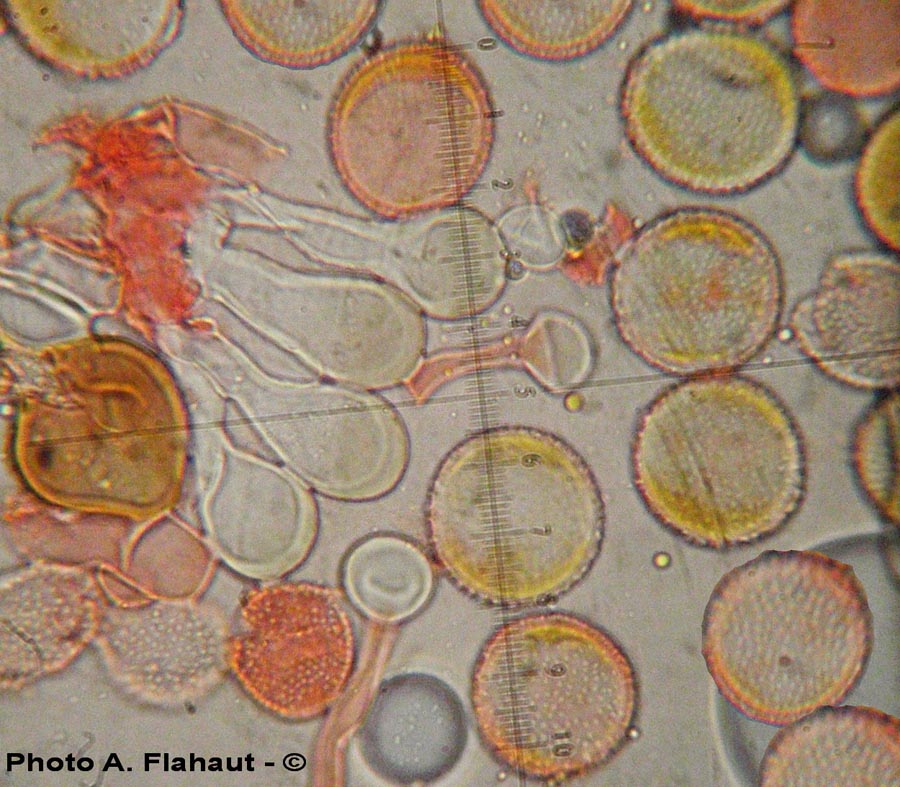 Puccinia brachypodii var. arrhenatheri