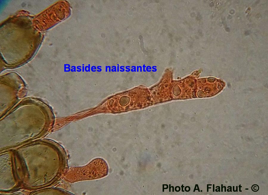 Puccinia cnici-oleracei