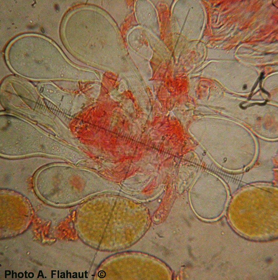 Puccinia magnusiana