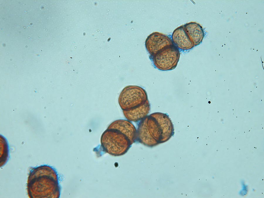 Puccinia umbilici