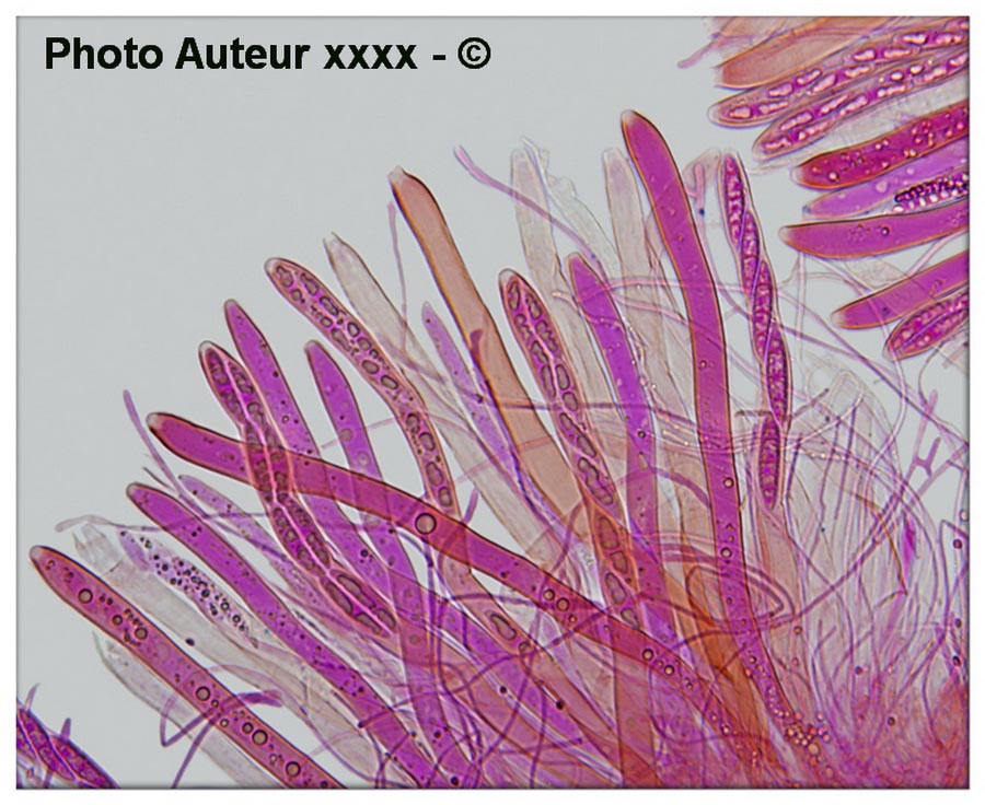 Ascocoryne sarcoides