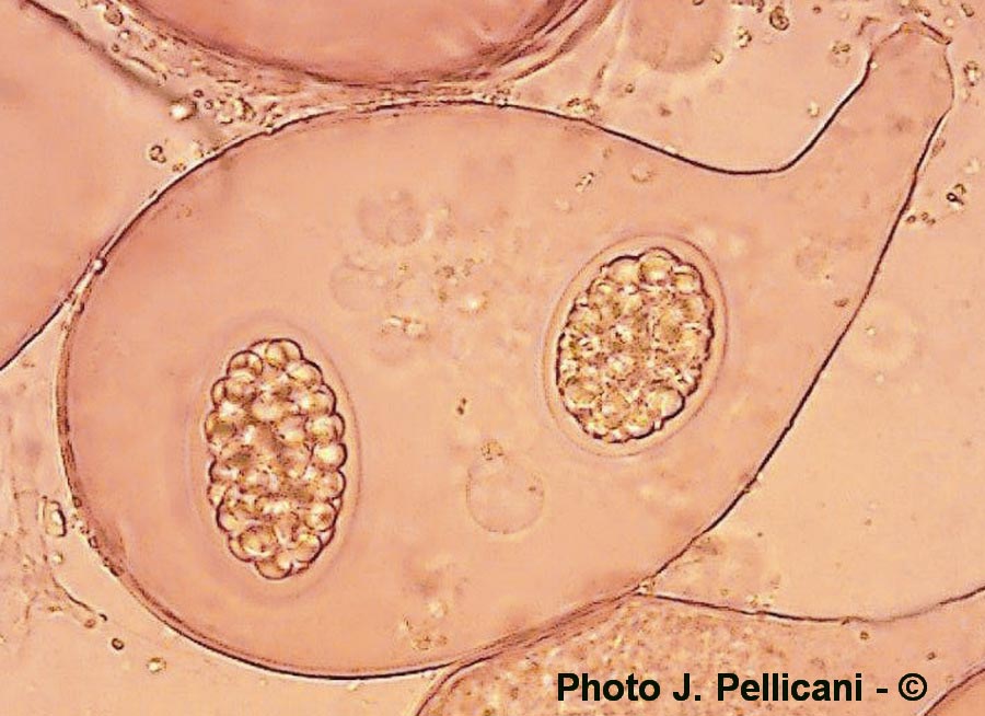 Choiromyces meandriformis