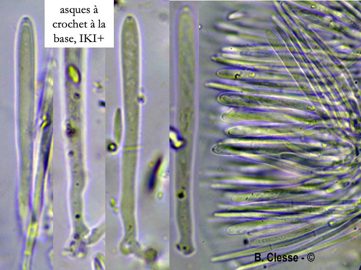 Dasyscyphella nivea