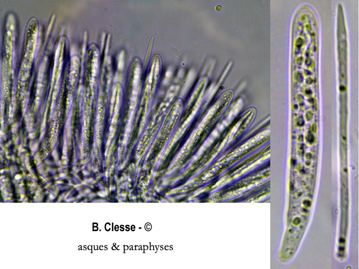 Incrucipulum ciliare