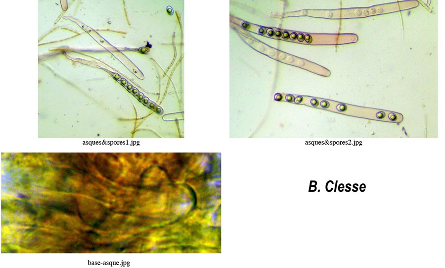 Octospora excipulata