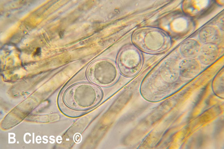 Octospora excipulata