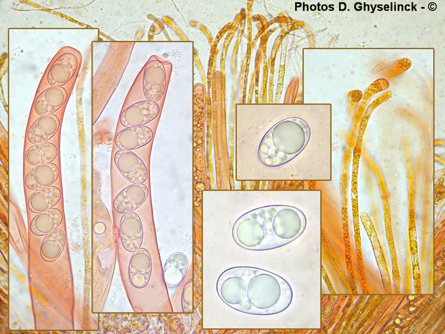 Octospora humosa