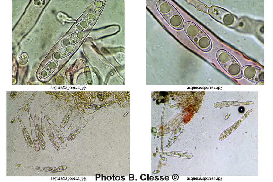 Octospora musci-muralis