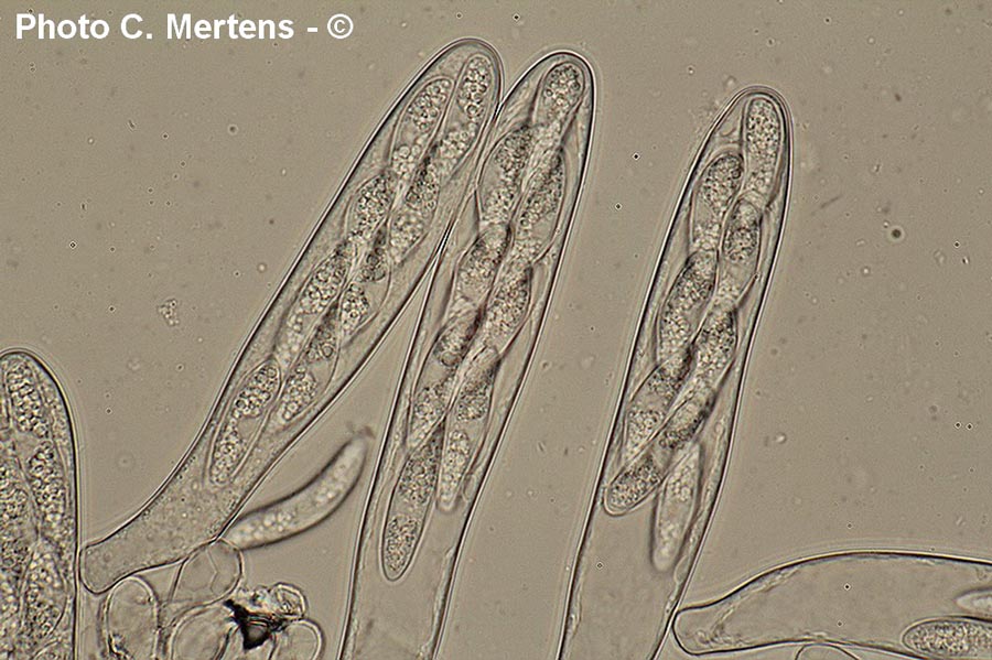 Pezicula myrtillina