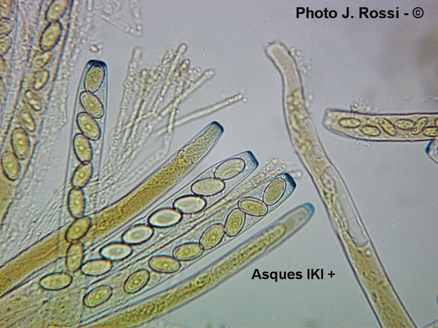 Peziza vesiculosa