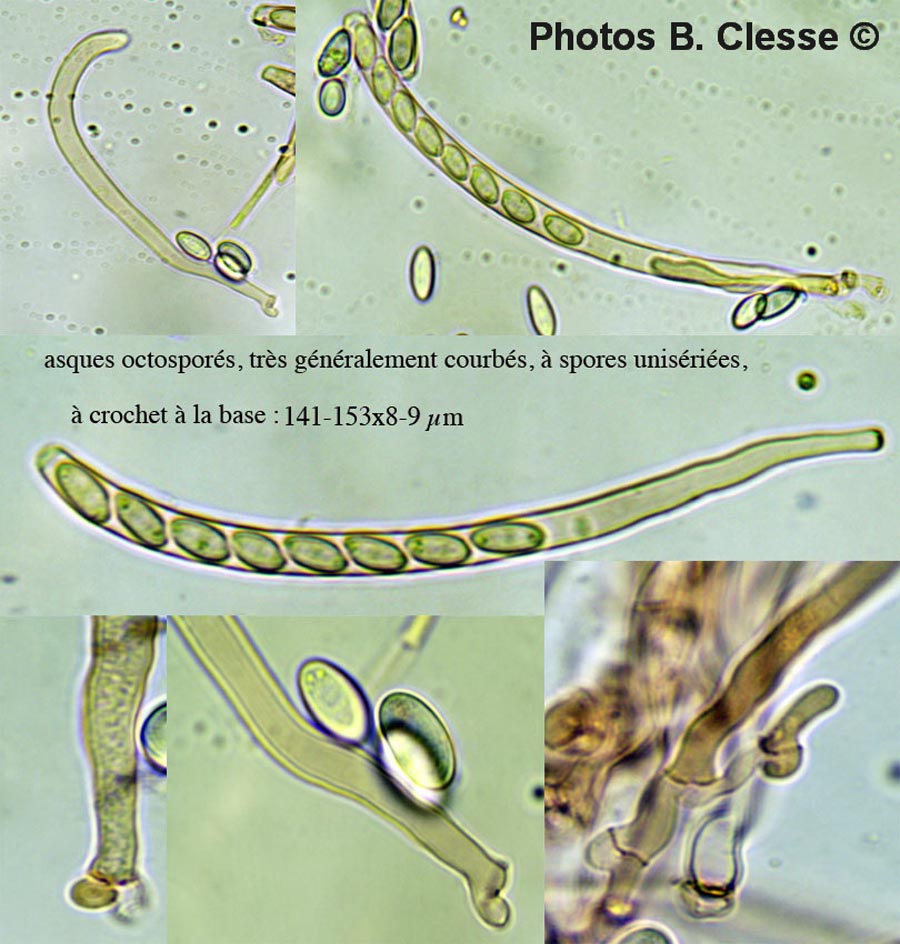 Sclerotinia binucleata