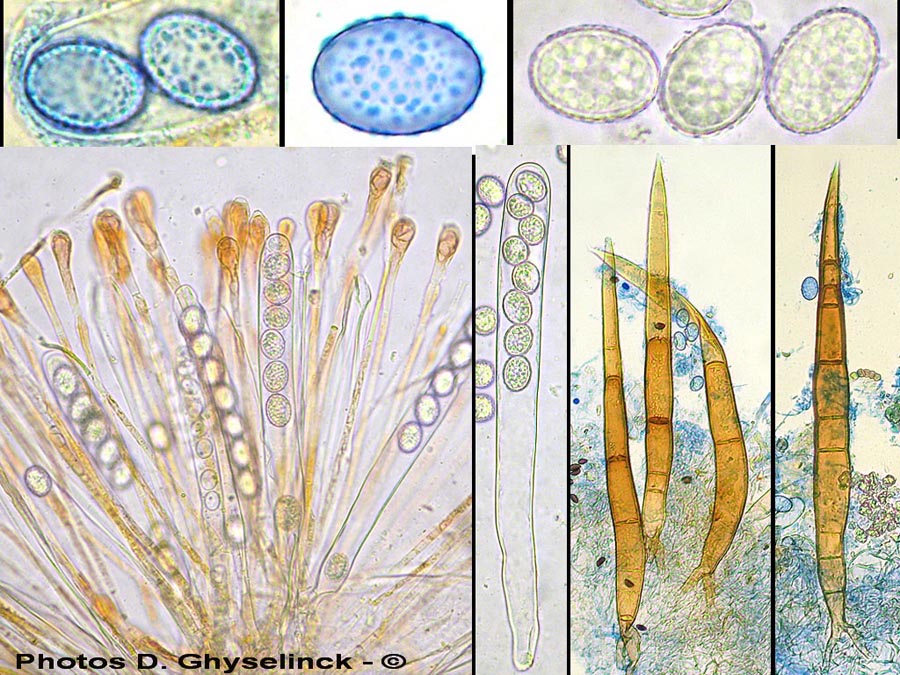 Scutellinia umbrorum