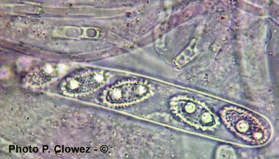 Sowerbyella polaripustulata