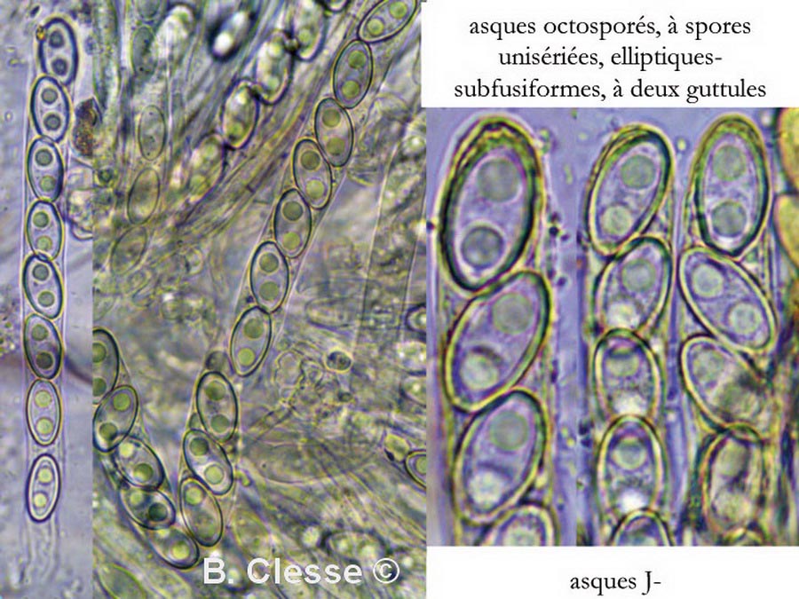 Trichophaea abundans